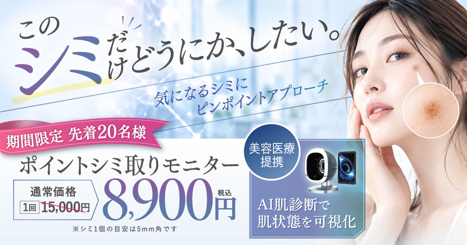 ポイントシミ取りモニター