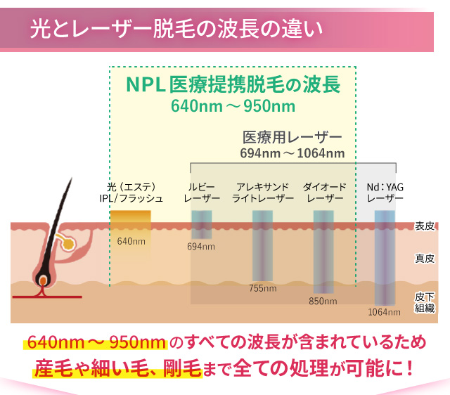 光とレーザー脱毛の波長の違い