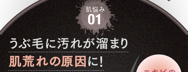 肌悩み01 うぶ毛に汚れが溜まり肌荒れの原因に！