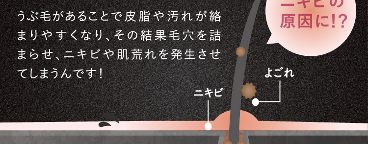 うぶ毛があることで皮脂や汚れが絡まりやすくなり、その結果毛穴を詰まらせ、ニキビや肌荒れを発生させてしまうんです！