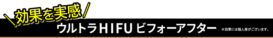効果を実感 ウルトラHIFUビフォーアフター