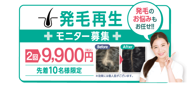 発毛再生モニター募集　２回9,900円（税込）先着10名様限定