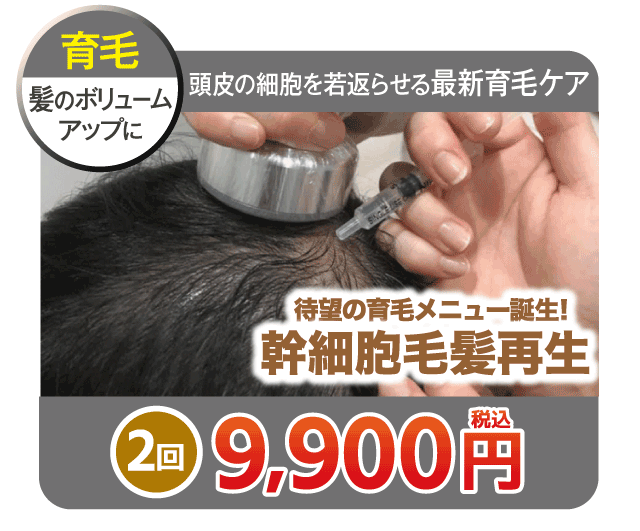 お得な体験メニューのご紹介　幹細胞毛髪再生2回9,900円（税込）