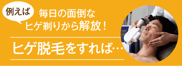 ヒゲ脱毛をすれば、毎日の面倒なヒゲ剃りから解放！